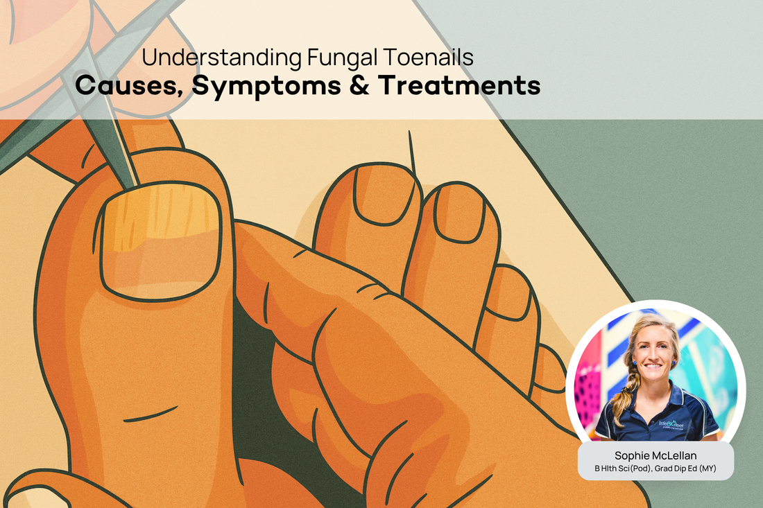 What Are Fungal Toenails? A Podiatrist Explains the Causes and Treatment
